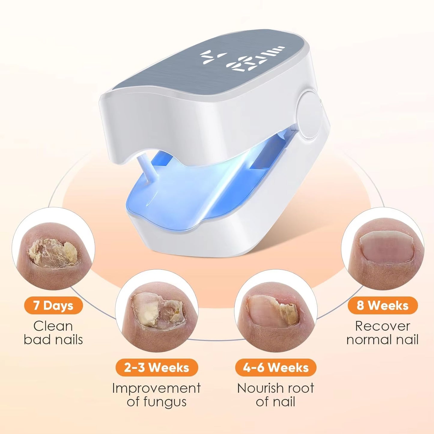 Rapid-Action Healthy Nail LED Revitalizer